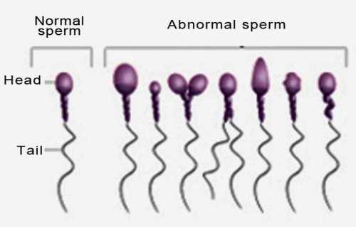 Даже малейшее несоответствие сперматозоида эталону приводит к незамедлительной выбраковке этой клетки